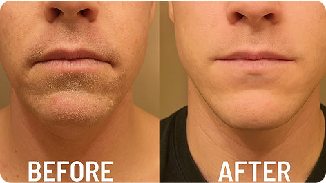 Before and after comparison for Jason K.