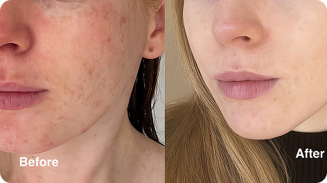 Before and after comparison for Kiara P.