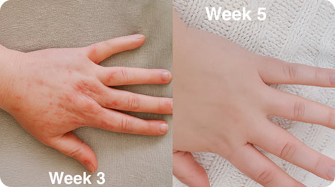 Before and after comparison for Carly T.